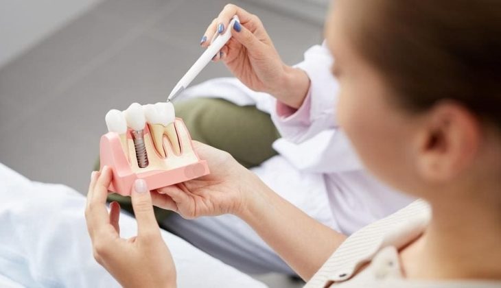 Are dental implants right for you?